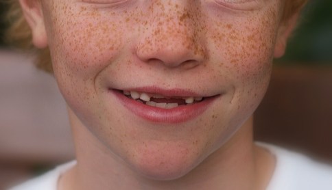 enfant avec tâches de rousseur